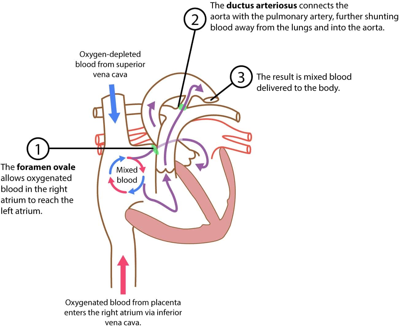 Illustration ur kursen EKG-tolkning for barn og nyfødte